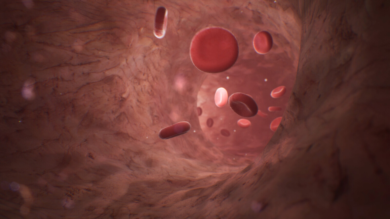 UE4 Bloodstream