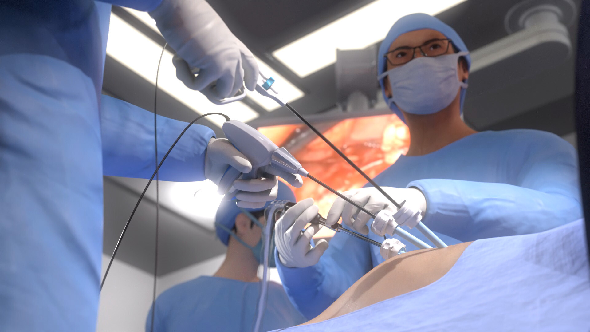 Tim Shaw - Laparoscopy Operation Scene