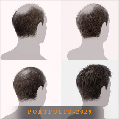 Male_Hairs_Stages