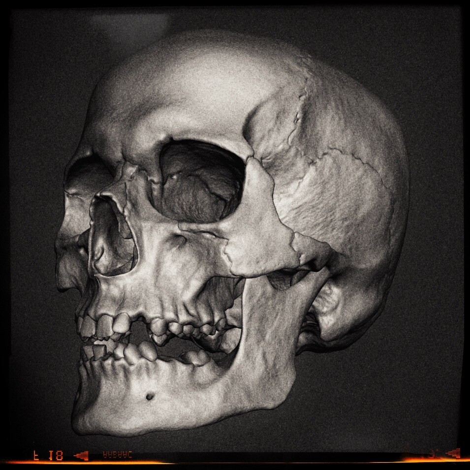 MetaHuman Anatomical Study (WIP)