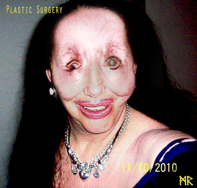 plastic surgery fail