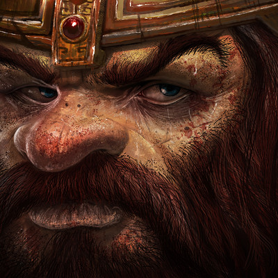 Saad irfan dwarf