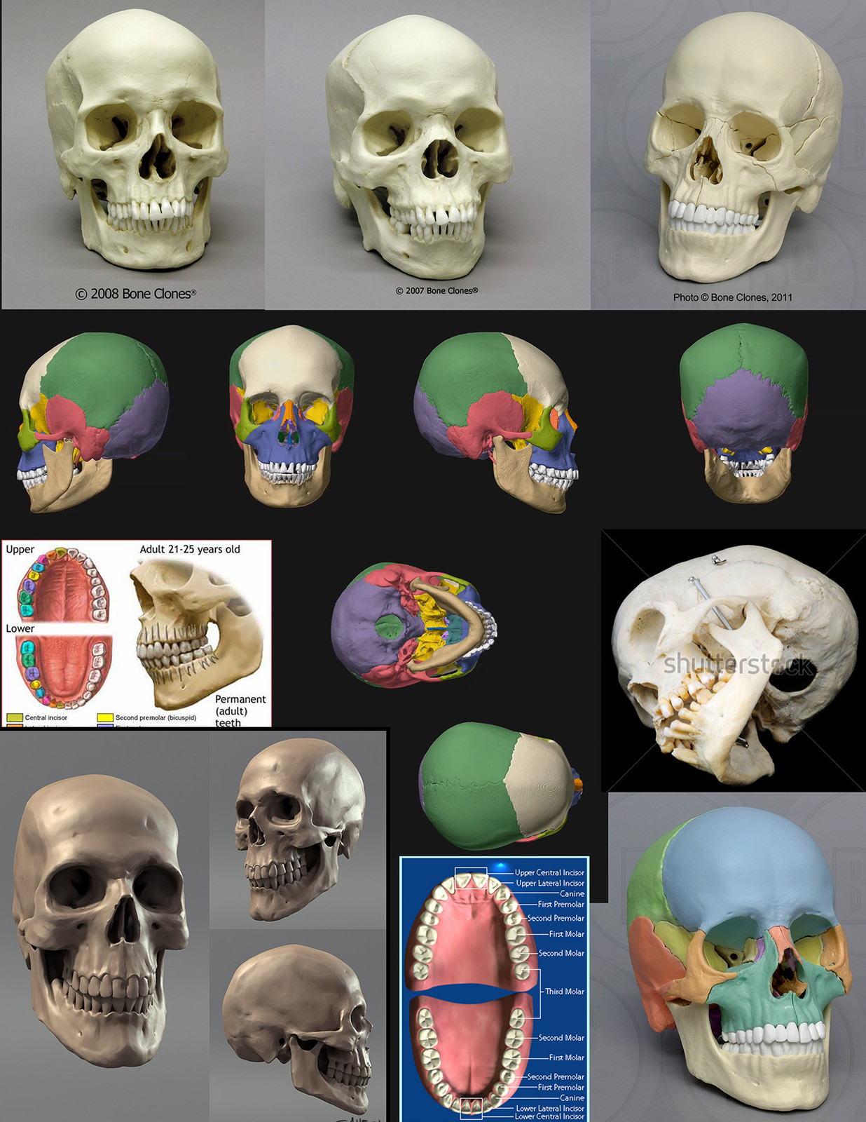 This is the refs collection  I used.  Images from boneclones.com, medical websites, and one digital skull from an artist that I unfortunately can't find anymore and would like to credit for the image here.