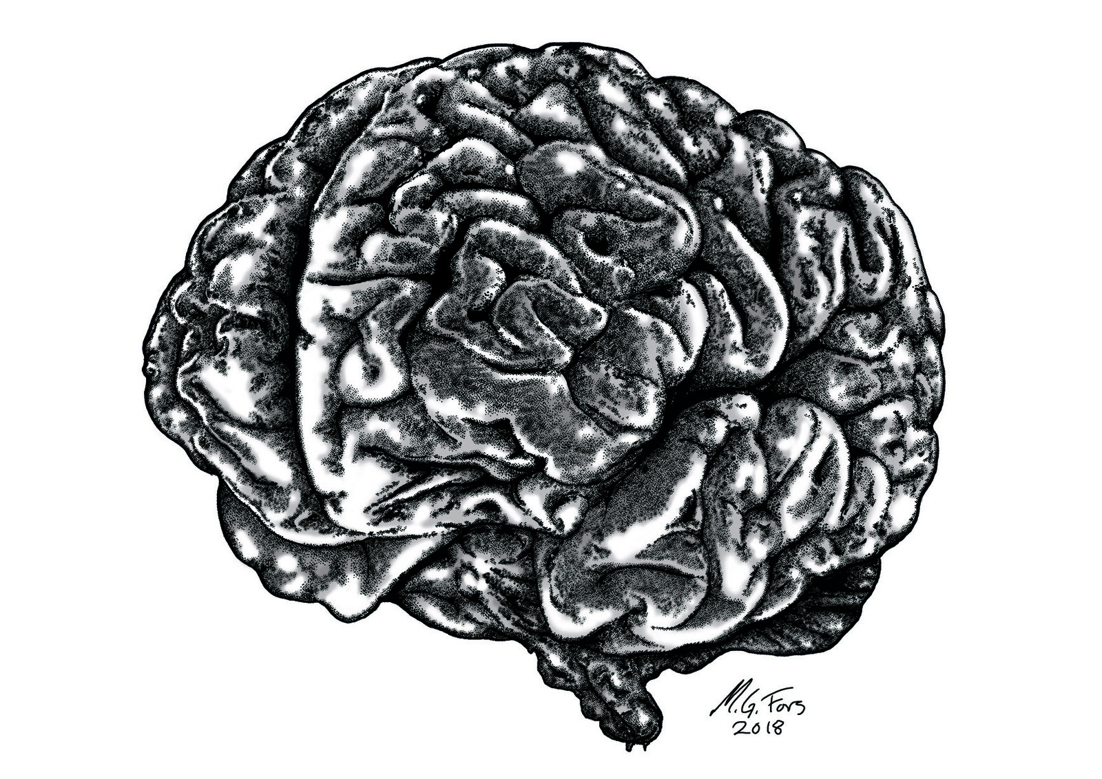 Anatomical Brain