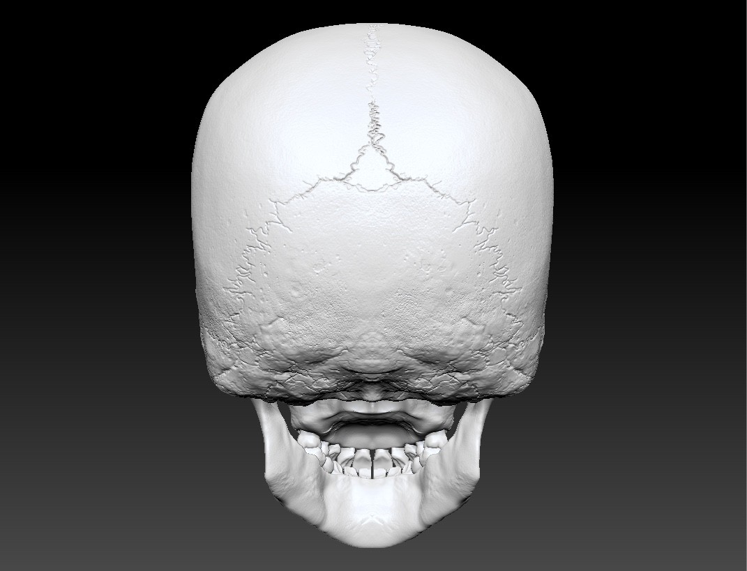 Детский череп фото. Рентгенограмма черепа новорожденного. Рентген черепа младенца зубы.