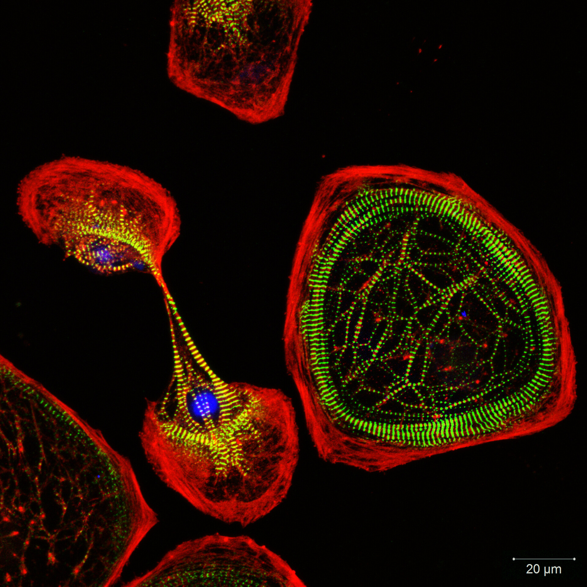 cultured heart muscle cells