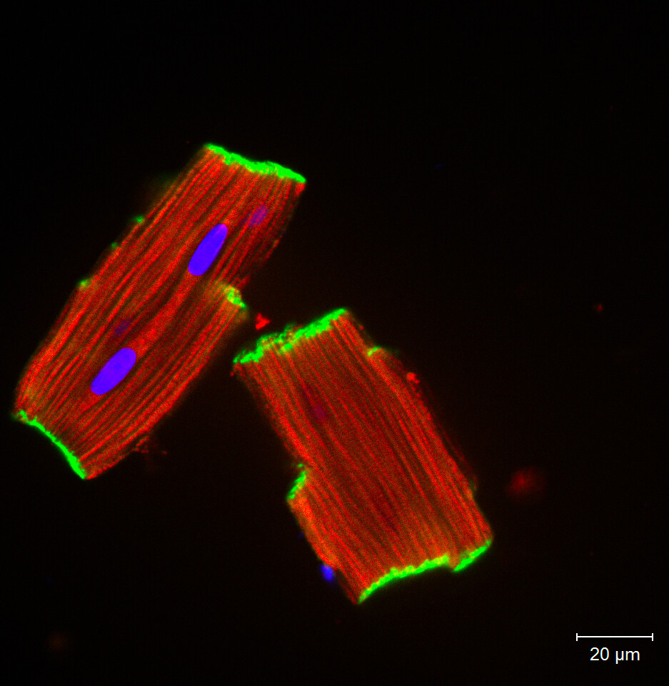 freshly isolated heart muscle cells from an adult animal