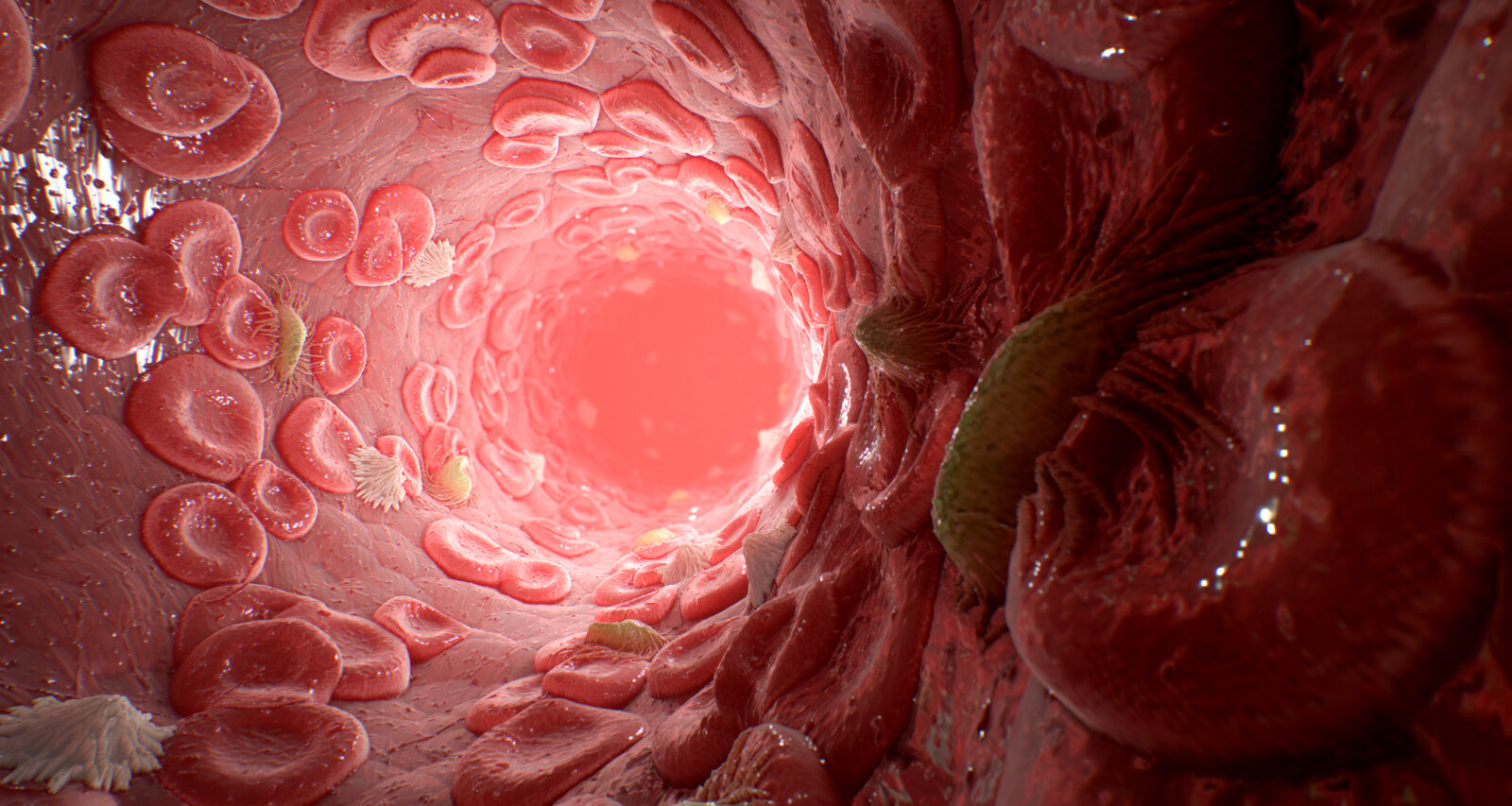 inside the vein, actually cylinder with reverse normals