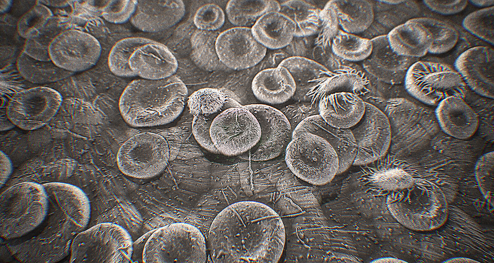 Electron Microscope effect