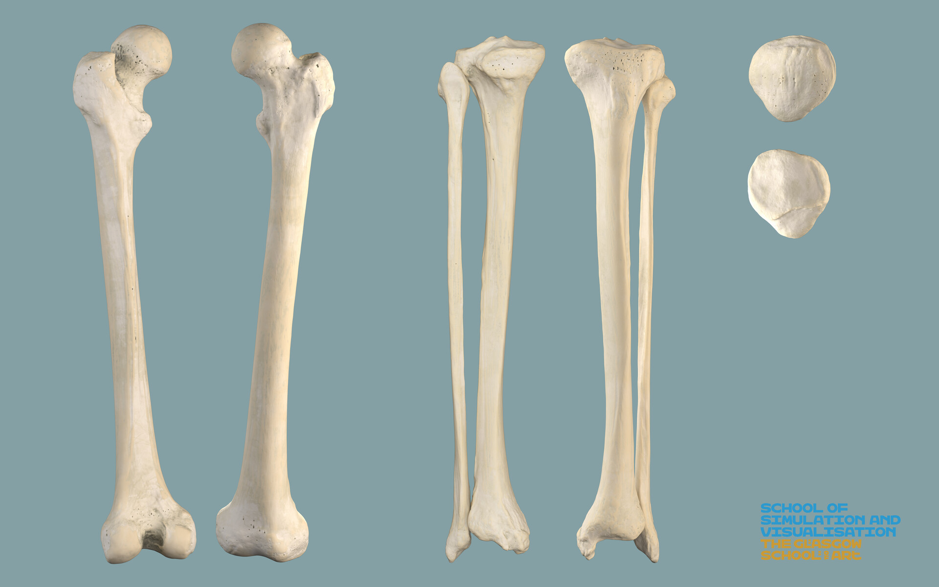 Bones Australopithecus boisei Cranium KNM-ER 406 - Bone Clones