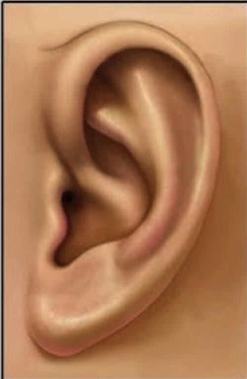 Ear reference top