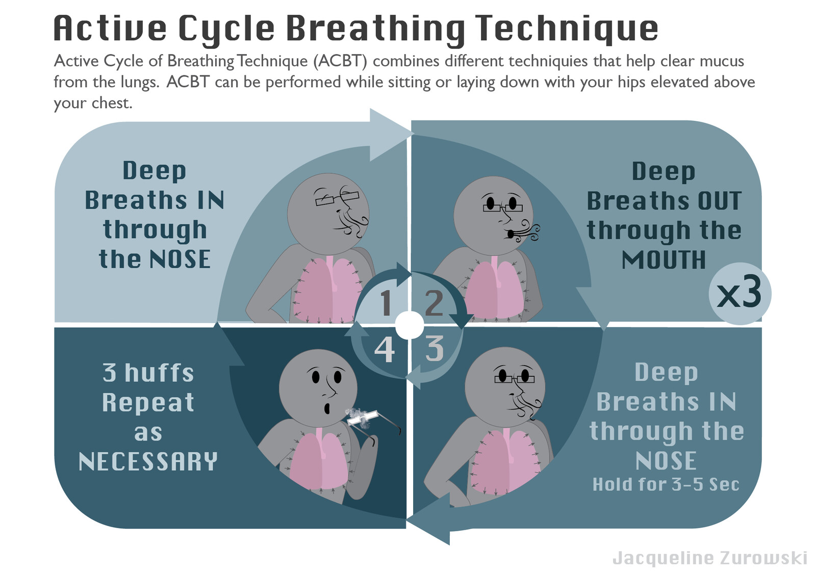cycle technique