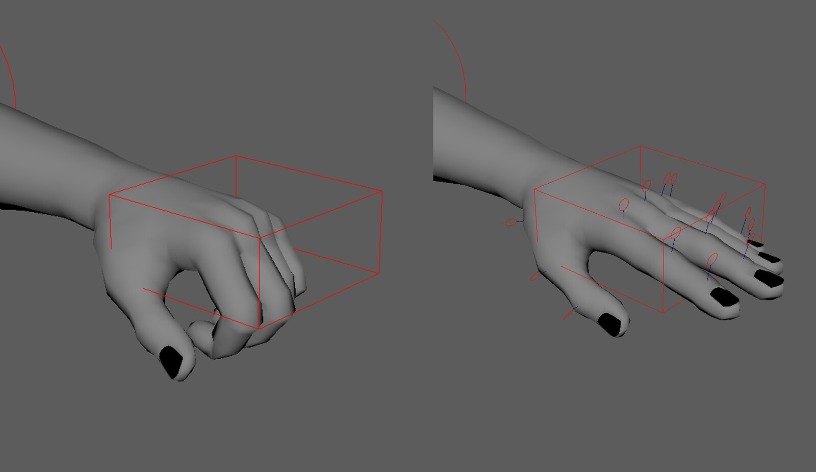 Hand deformations