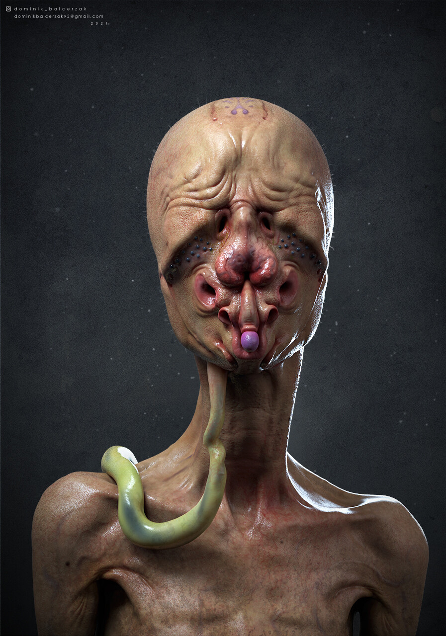 cyclops human mutation
