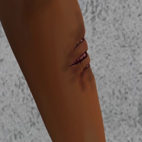 Amy - Arm Scrapes Close-Up