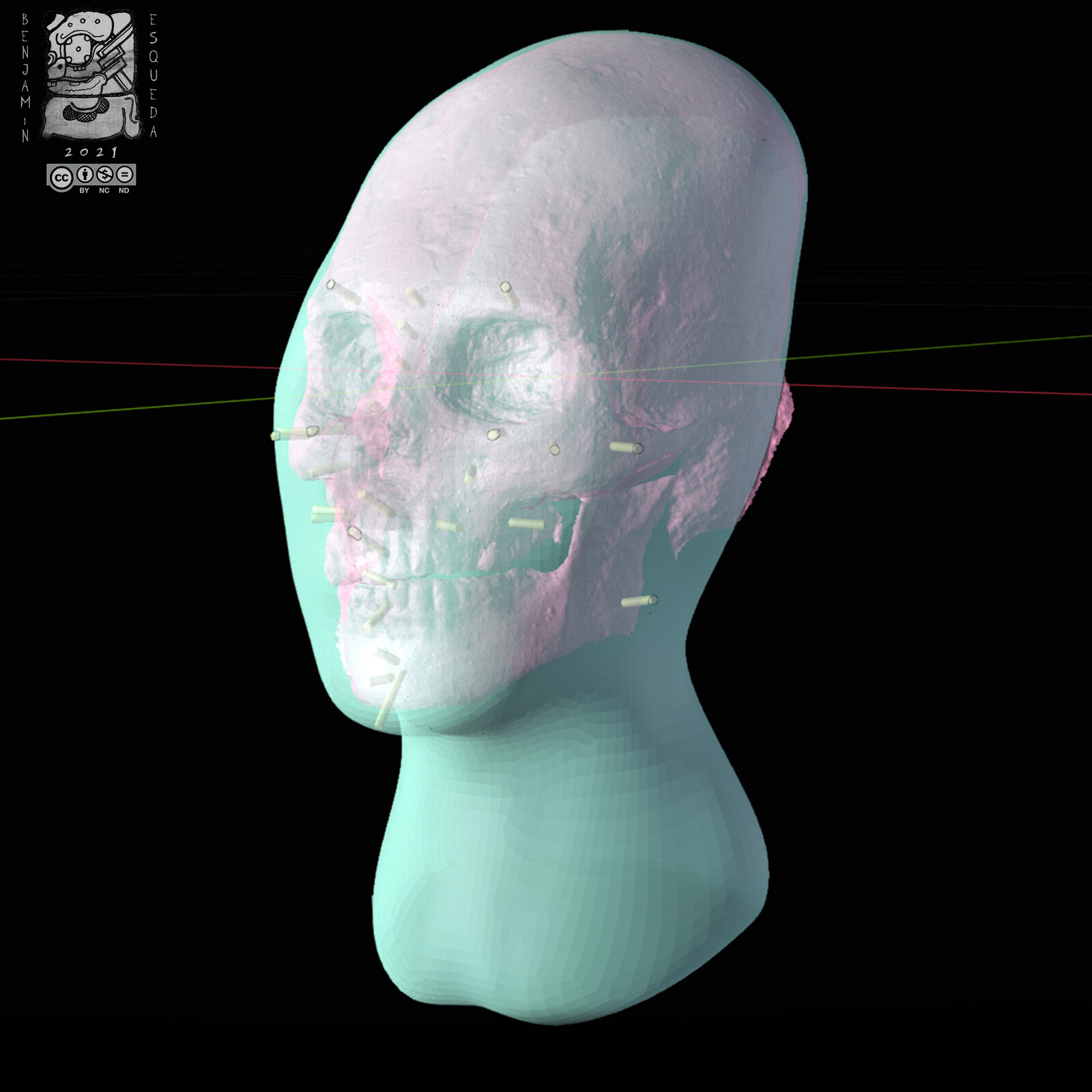 Xray of skull and a advance form of sculpting.