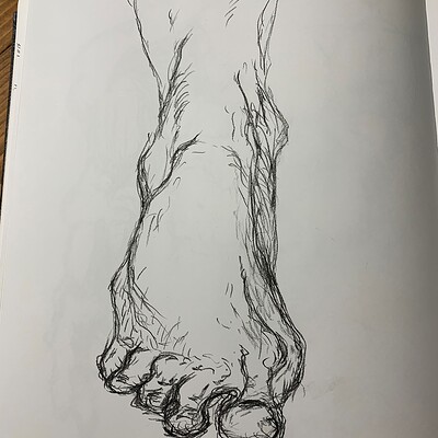 Bridgman Ankle-Foot Study