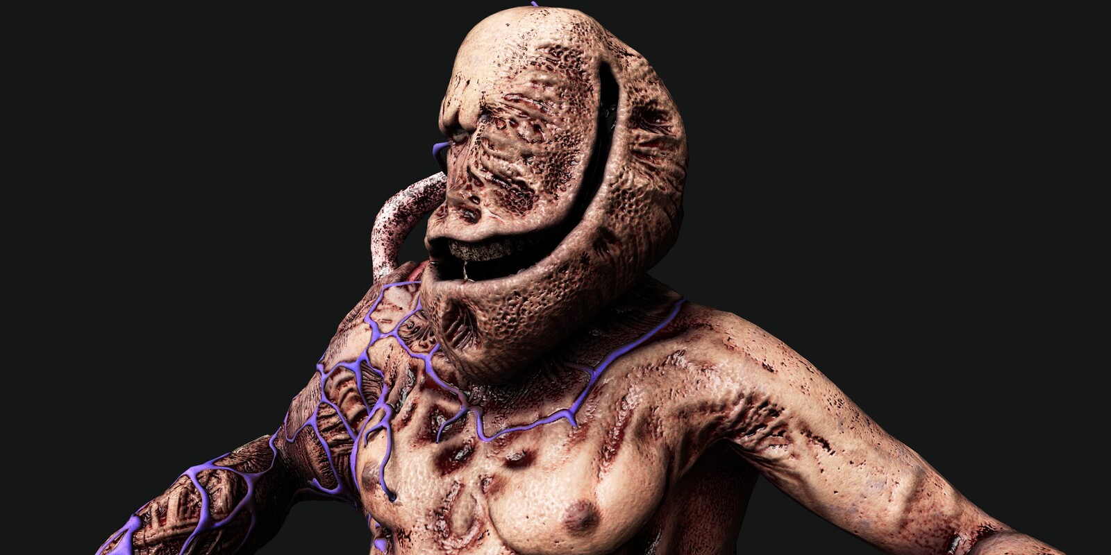 Infester