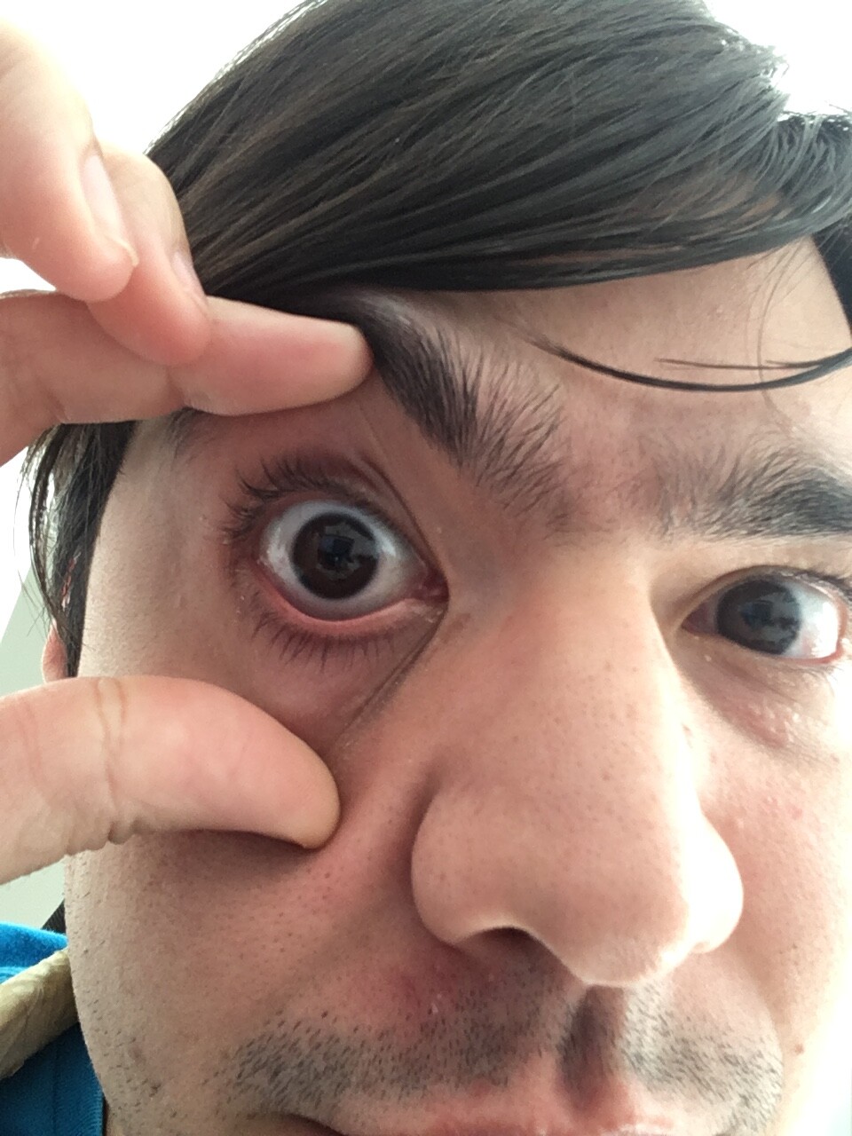 Eye texture