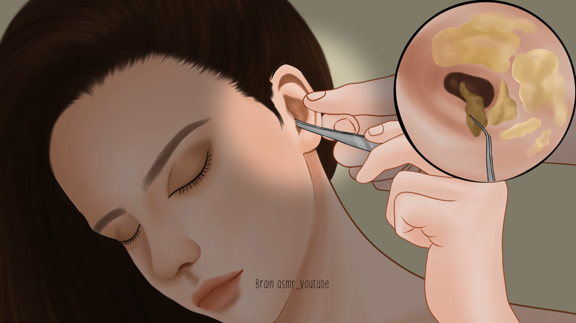 ArtStation - [ASMR] Pimple popping removal and Ear cleaning with endoscope  | Acne treatment animation