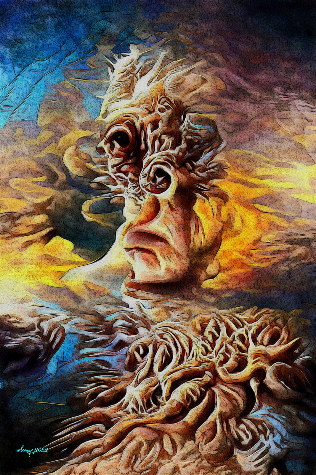 315