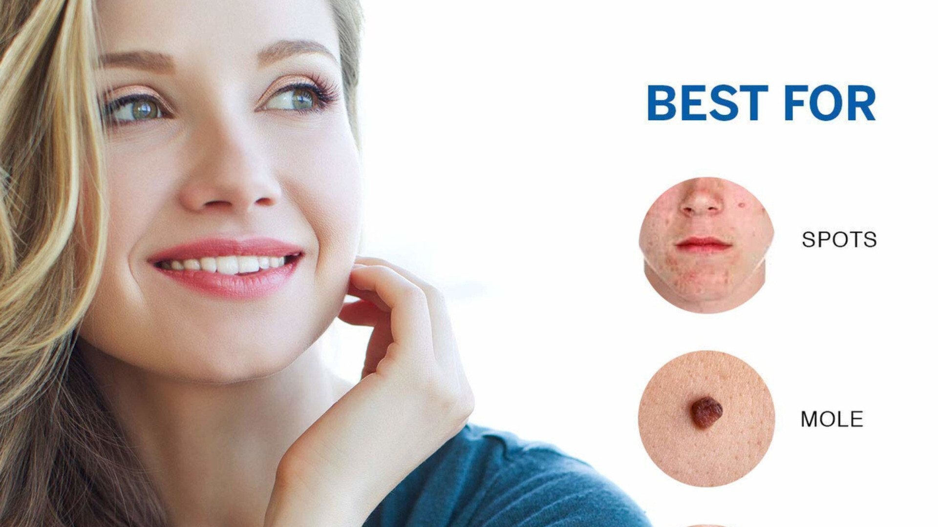 Artstation amarose skin tag remover reviews how to use skin tag