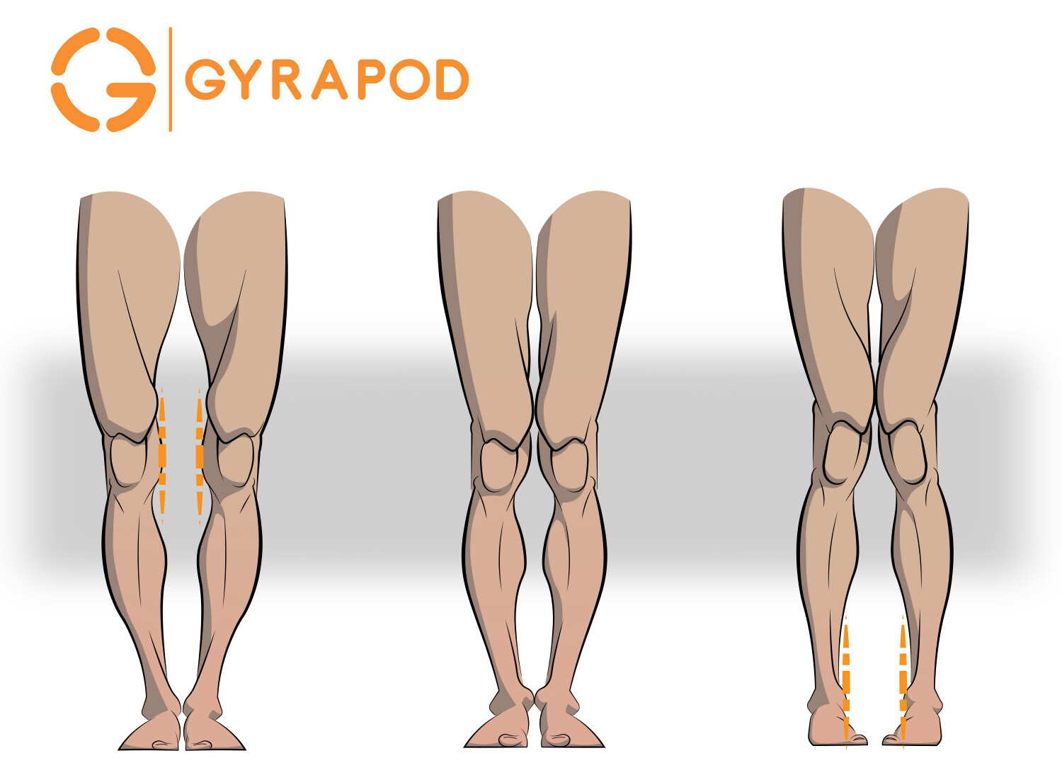 Knock-knees or no? Here's a lineup of one of Gyrapod's assessment categories.