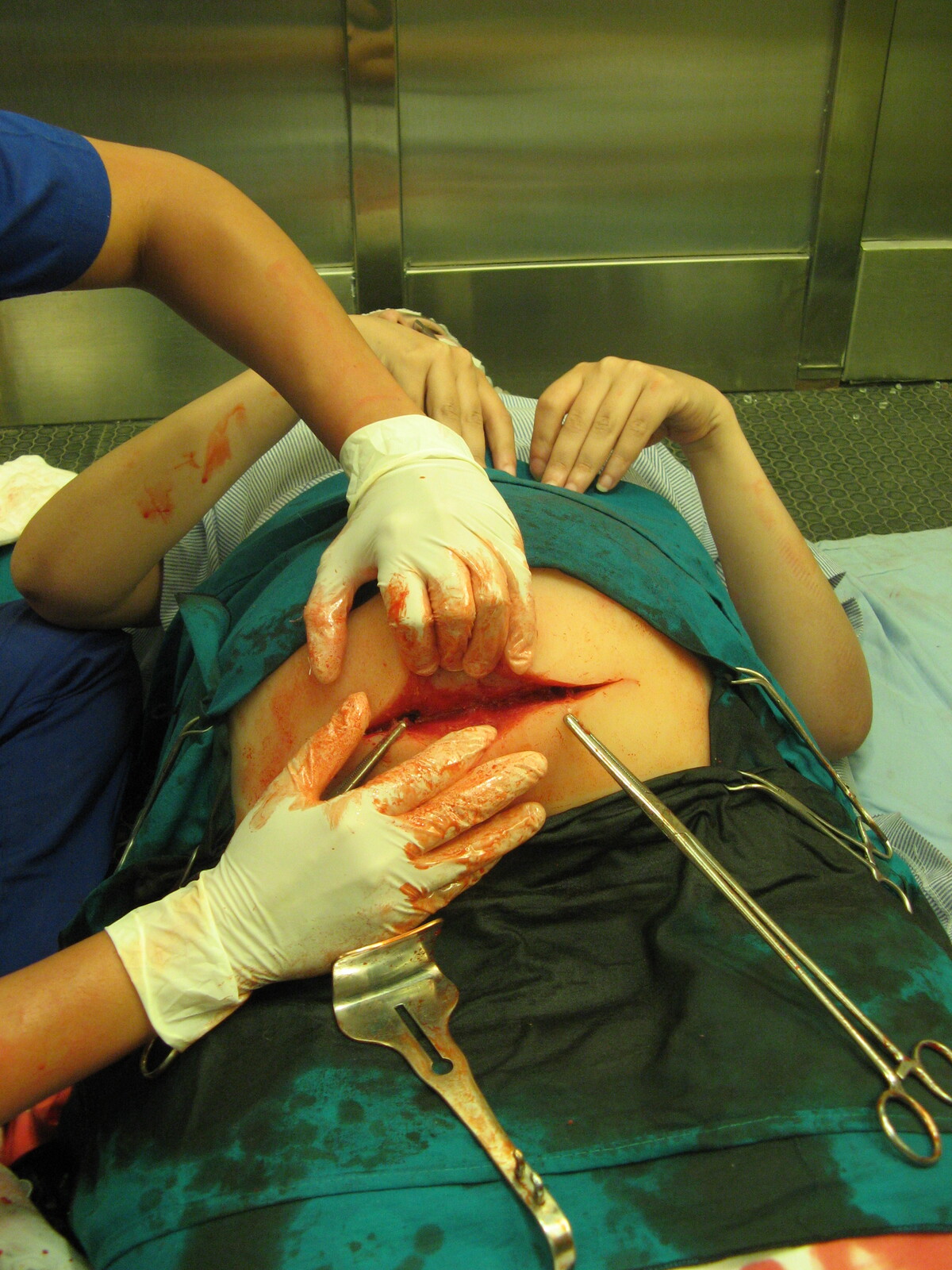 "Critical Moments" Pregnant belly for c-section