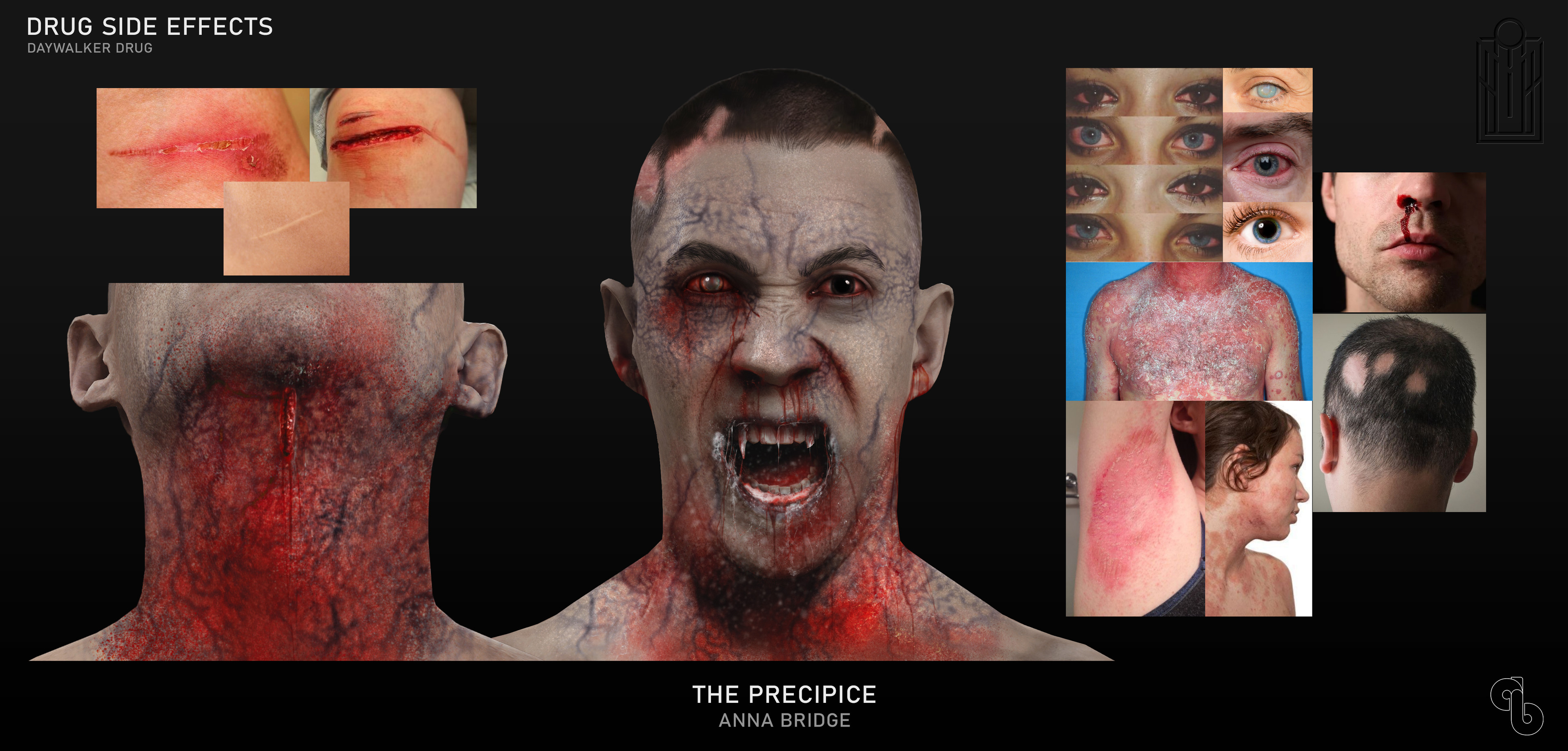 References