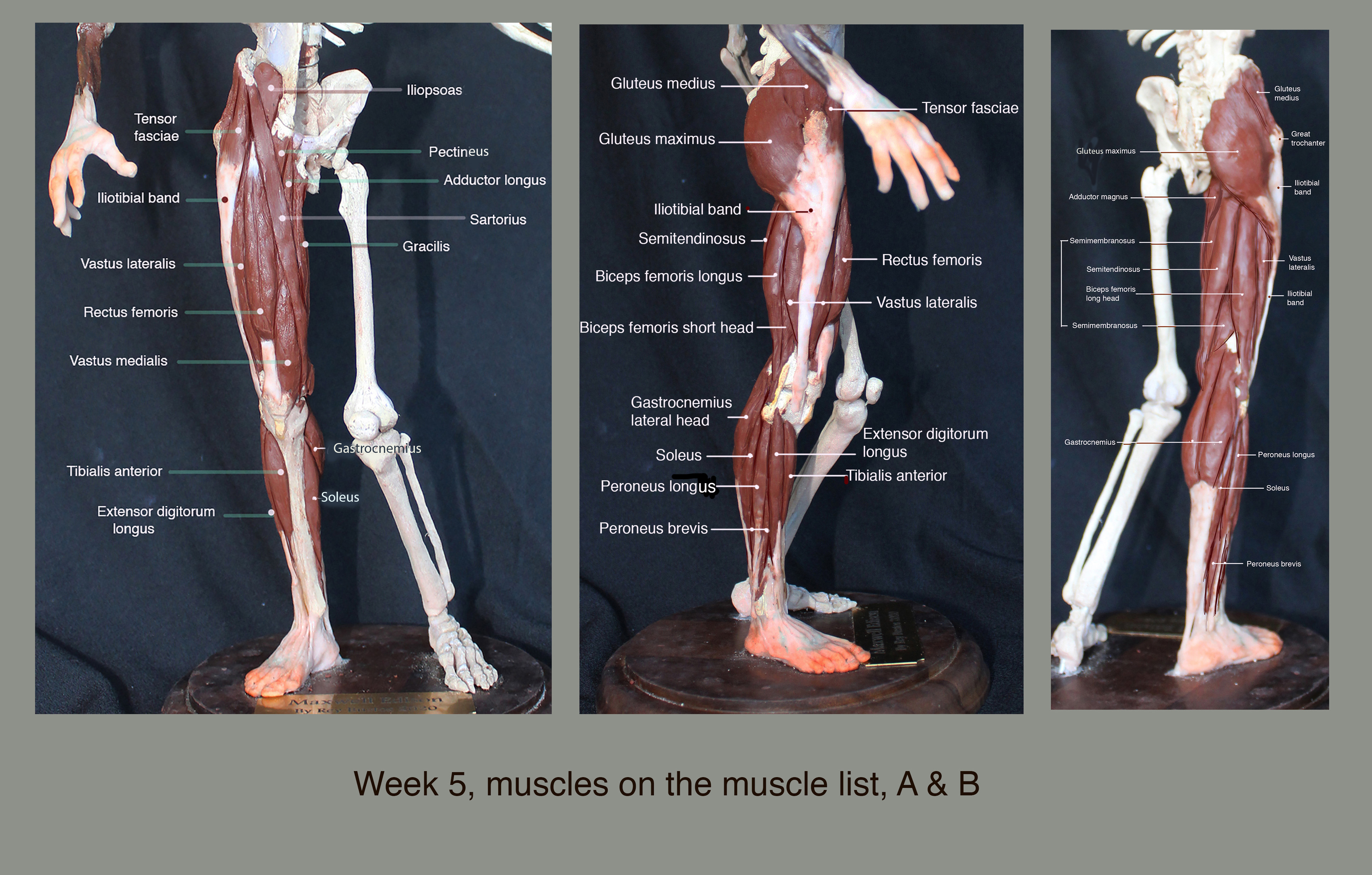 Ecorche' lower limb,labeled