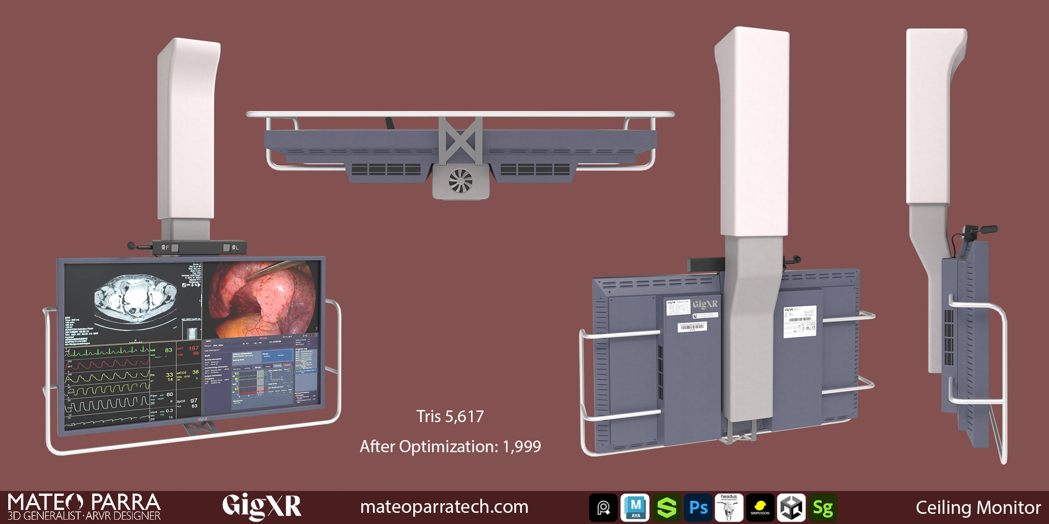 Fluroscopy Ceiling Monitor