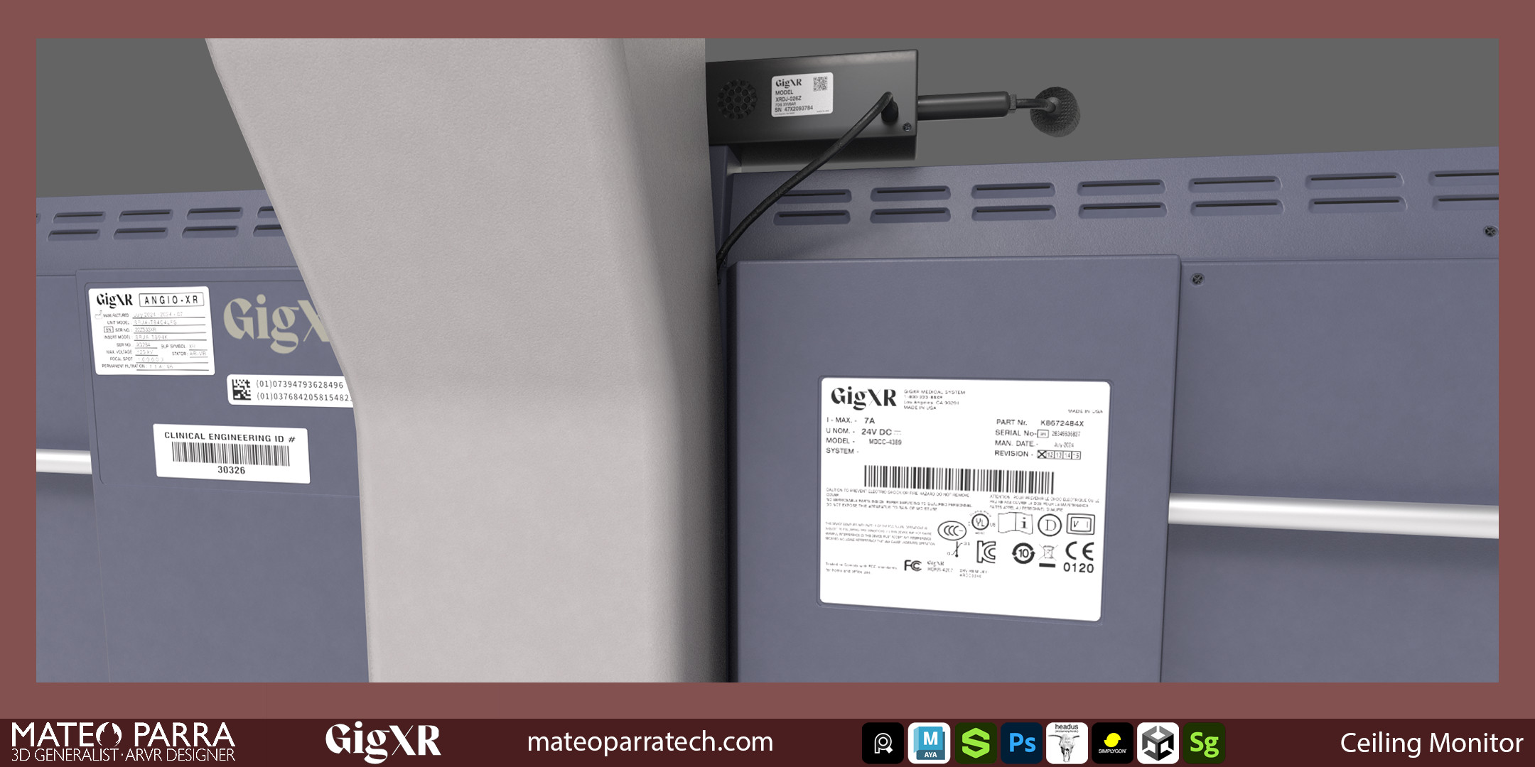 Fluroscopy Ceiling Monitor Closeup to posterior details