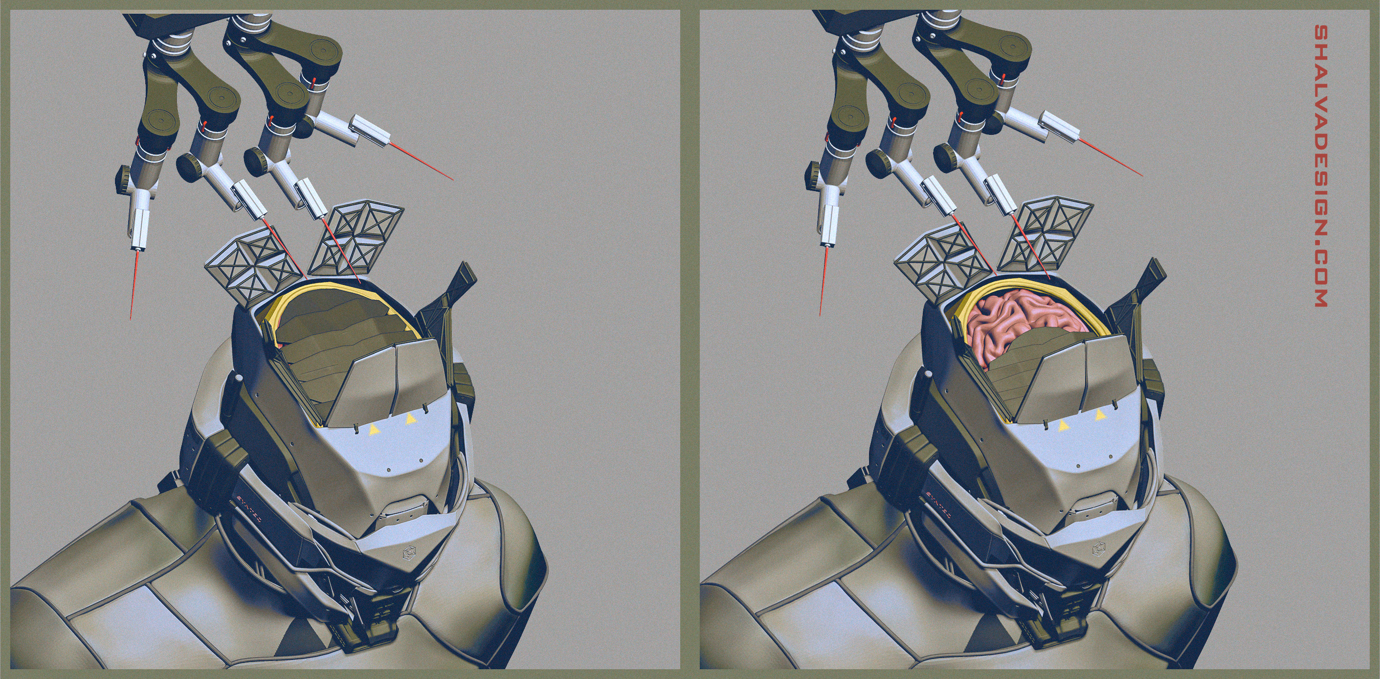 Neural processor installation