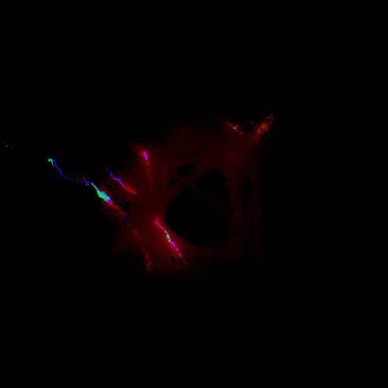 Neuronic Storm