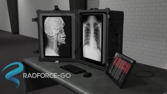 ArtStation - RADFORCE GO 01