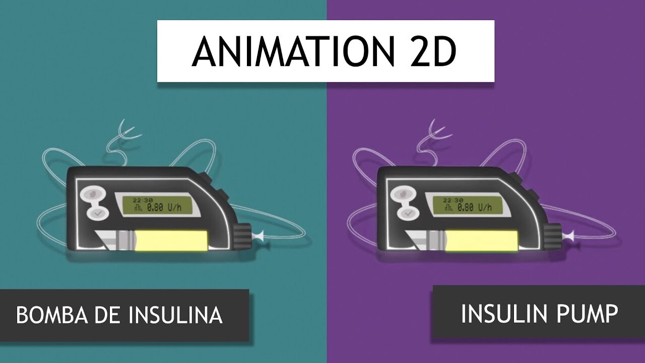 ArtStation - Insulin Pump - Animation 2D