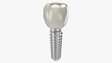 Tooth Implant