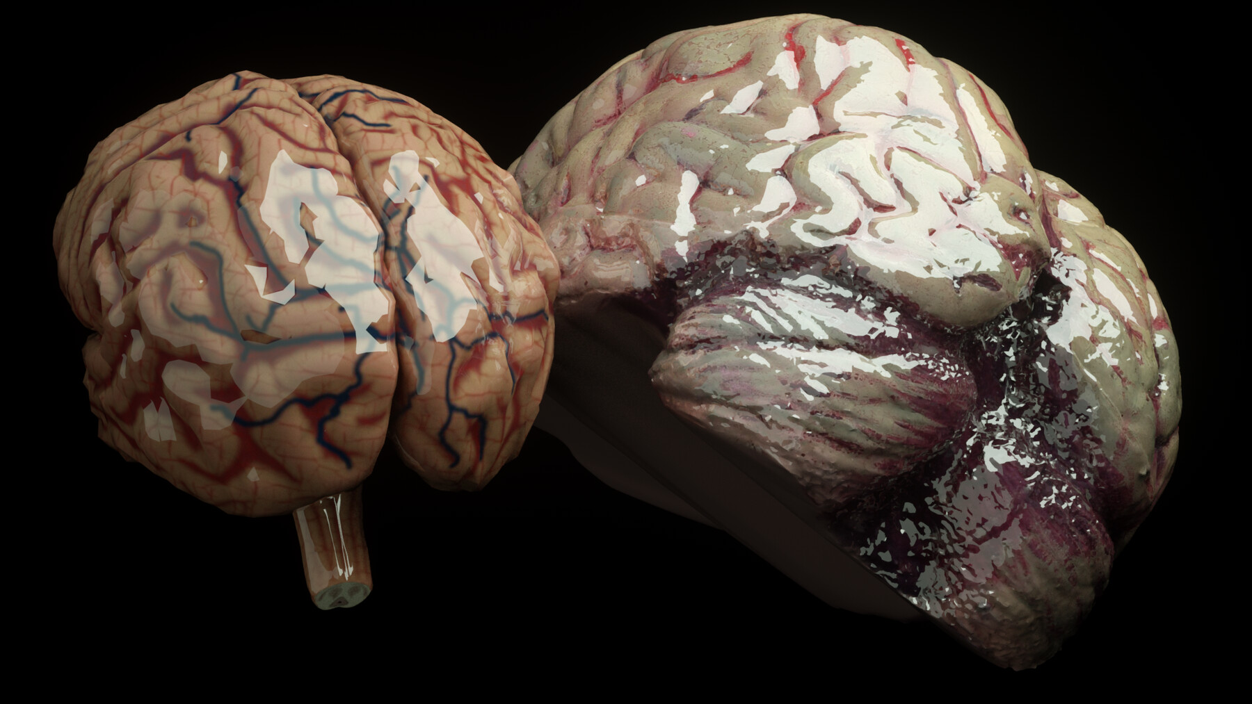 Yellow Human Brain Anatomical Model 3d: ilustrações stock 1267851703