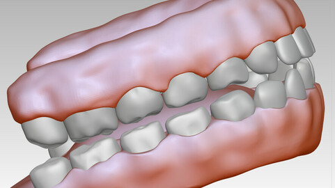 3D model download of dental gum, 3D oral model, dental tooth health model, 3D model material of human dental gum