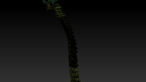 Three dimensional model of human cervical vertebrae, three-dimensional skeleton model of head and cervical vertebrae