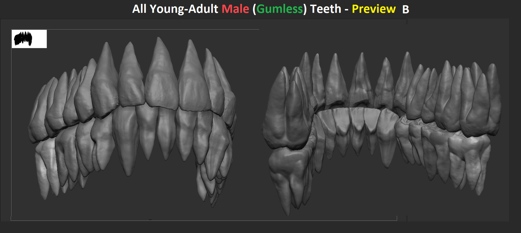 Artstation - Dentist-grade Human Teeth Scans - (young-adult Male 