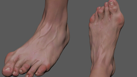 Deformation Foot1